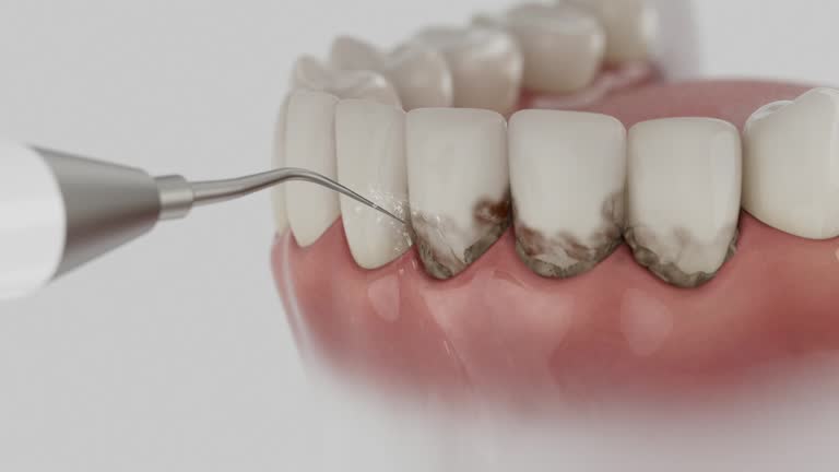 Reliable Dental Implants contractor in Glen Alpine, NC by Smile Center Dentistry